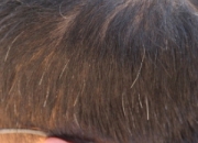 白發(fā)會越拔越多是真的嗎 改善日常習(xí)慣避免白頭發(fā)增加