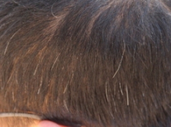 װl(f)ԽԽĆ ճ(x)T^l(f)