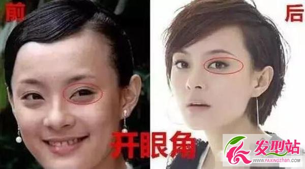 孫儷自爆整過容