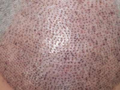 ֲl(f)ռtʲô ֲl(f)tίЧ