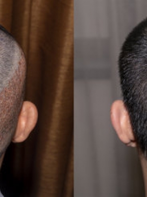 XTֲl(f)Ч(du)  ëҴr L(zhng)ٶ ܶ Ȼ ֏(f)r(sh)g