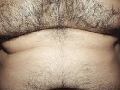 ël(f)ֲl(f)᣿˽P(gun)֪Rcע