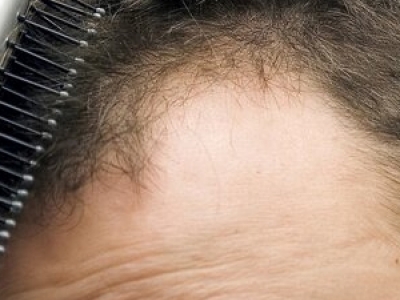 ֲl(f)Ól(f)ʿo(h) ЧÓl(f)}