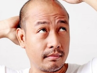 一天脫一百根頭發(fā)算脫發(fā)嗎?生理性與病理性脫發(fā)的區(qū)別及應(yīng)對方法