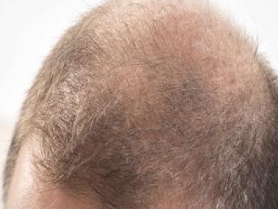 ^Ól(f)ֲl(f) ^l(f)ֲÓl(f)(wn)}