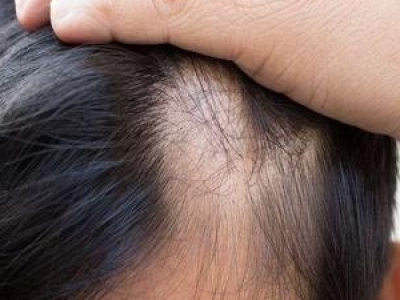 ֲl(f)gעʲô ֲl(f)goָ ֲl(f)αB(yng)