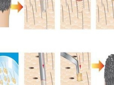 ëҲֲl(f) ëҲôk ֲl(f)ǰęzyco(h)