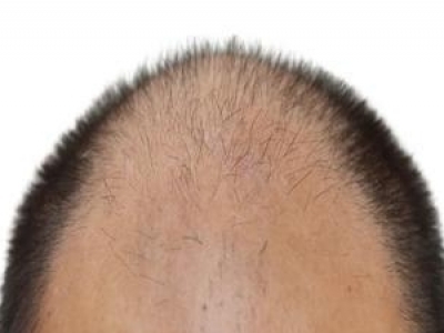 弉(j)Ól(f)ֲl(f) ֲl(f)g(sh)5m(yng)Y