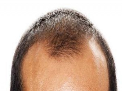 ֲl(f)ˎԔⳣˎＰע(xing)