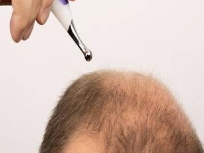 ^l(f)ϡmֲl(f)᣿˽ֲl(f)Чcg(sh)o(h)